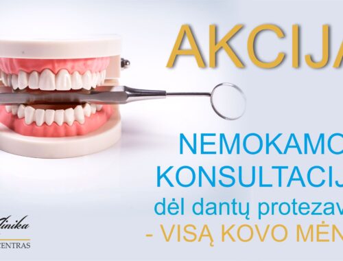 Nemokamos konsultacijos dėl dantų protezavimo